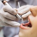 Endodonti nedir?